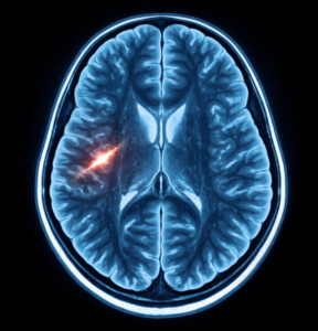 Sexisme et inégalités : une étude pointe  « une cicatrice sur le cerveau » des femmes